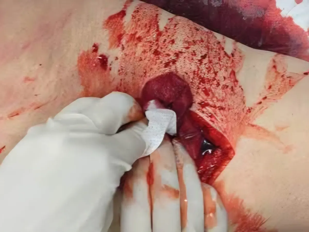 Wound packing em ferida simulada